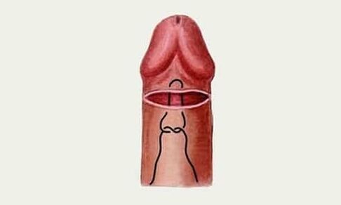 eikel penis